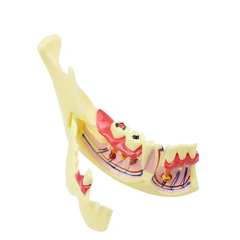 Модел ендодонтско лечение на зъби Анатомическая модел на Обучение Модел на Изследване на Стоматологични Материали
